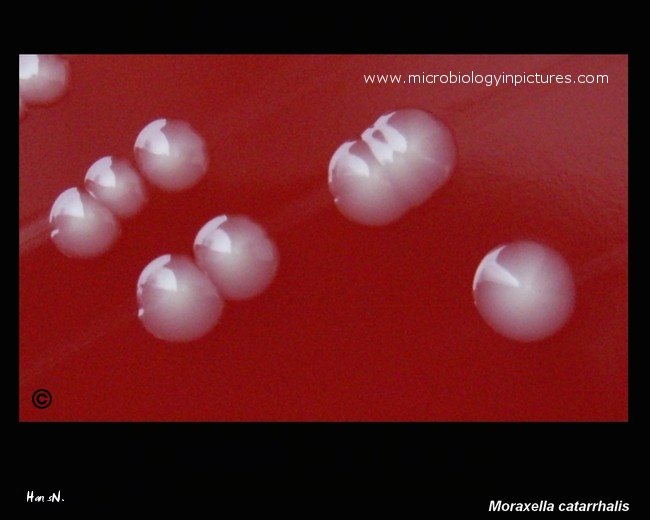 moraxella catarrhalis morphology on blood agar